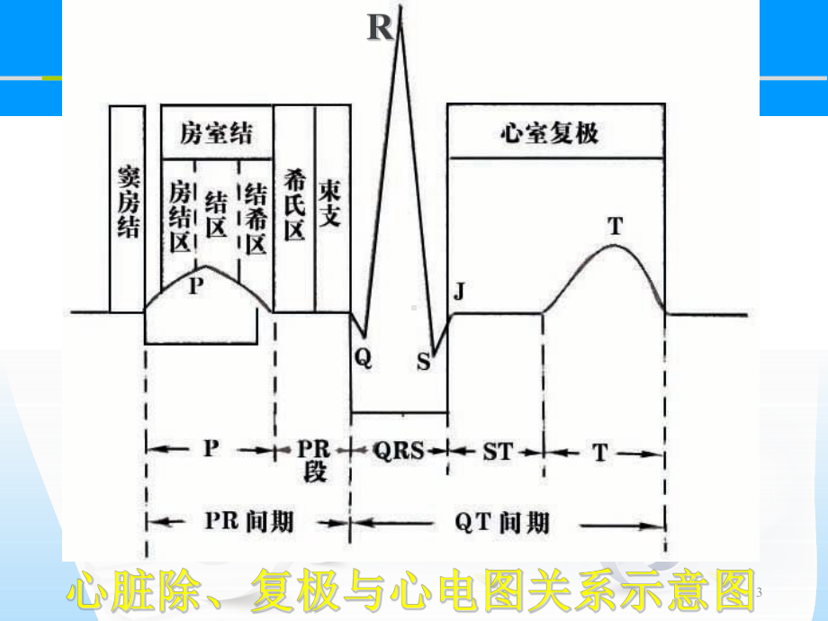 心电图基础图解教学课件.ppt_第3页