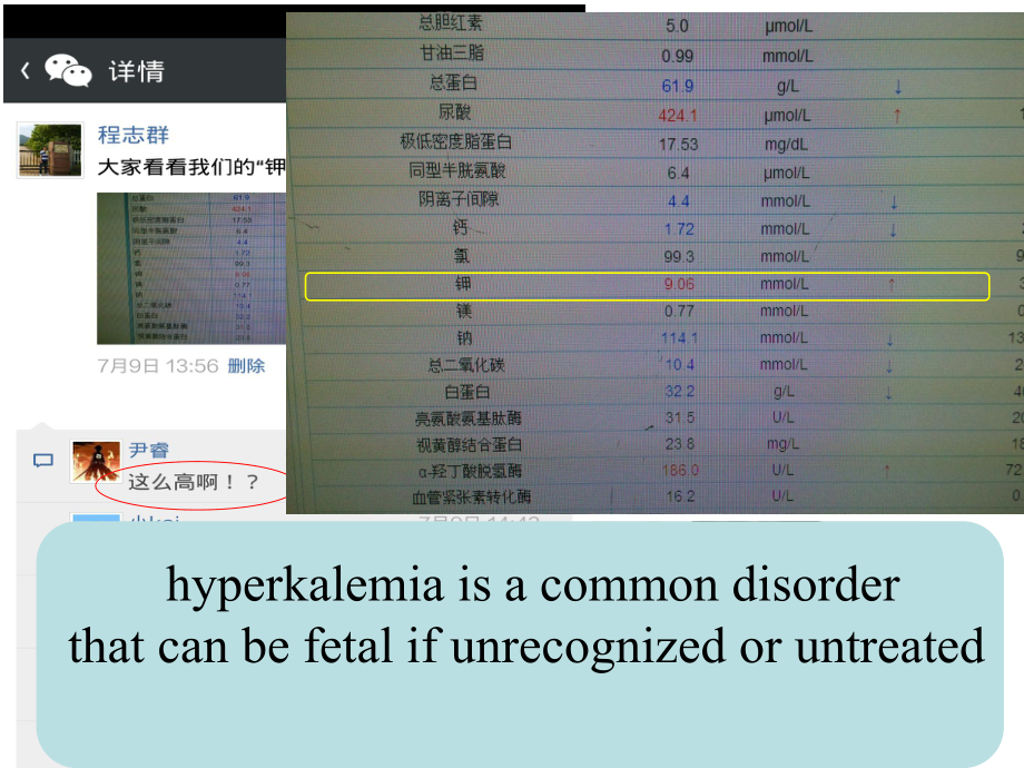 最详细高钾血症(中心医院肾内科)课件.ppt_第2页