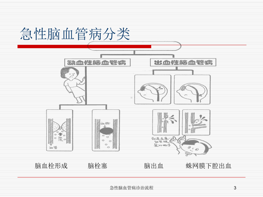 急性脑血管病诊治流程培训课件.ppt_第3页