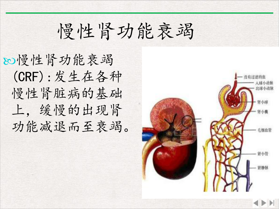 慢性肾功能衰竭护理查房完整版课件.ppt_第2页