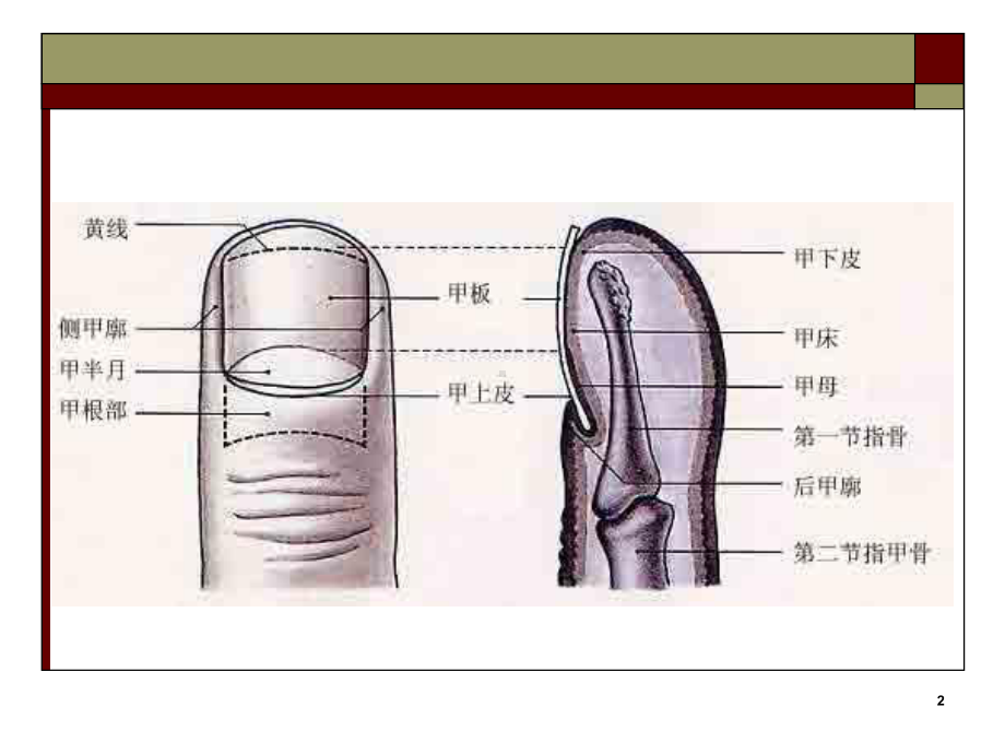 手化脓性感染教学课件.pptx_第2页