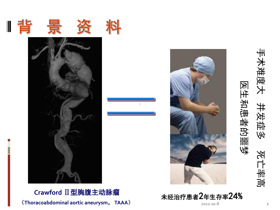 常温胸腹主动脉替换参考课件.ppt_第2页