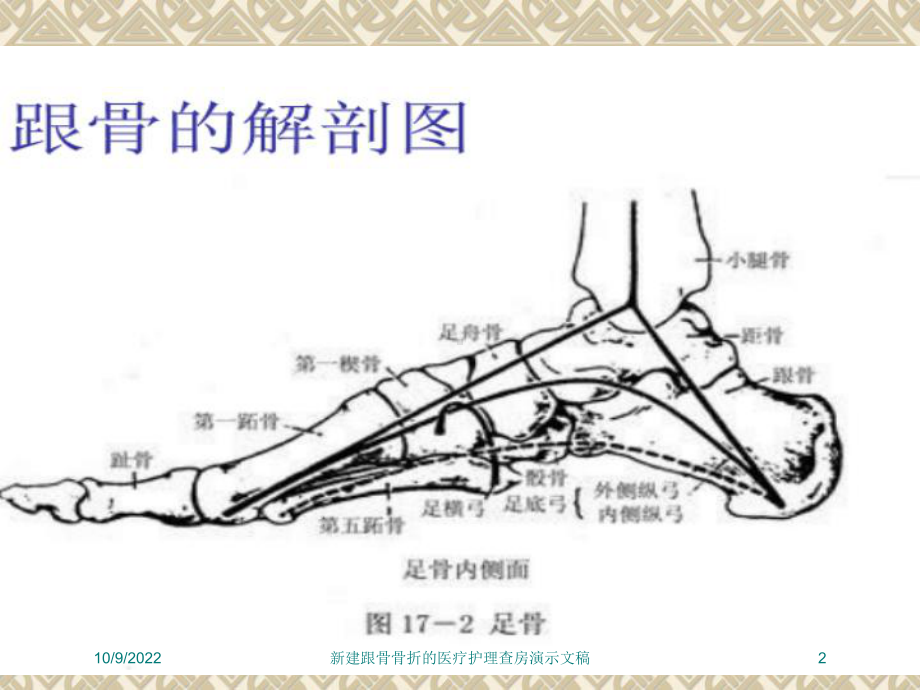 新建跟骨骨折的医疗护理查房演示文稿培训课件.ppt_第2页