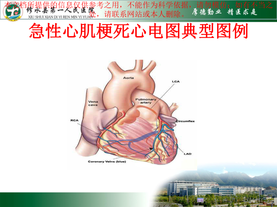 急性心肌梗死和常见心电图识别培训课件.ppt_第1页