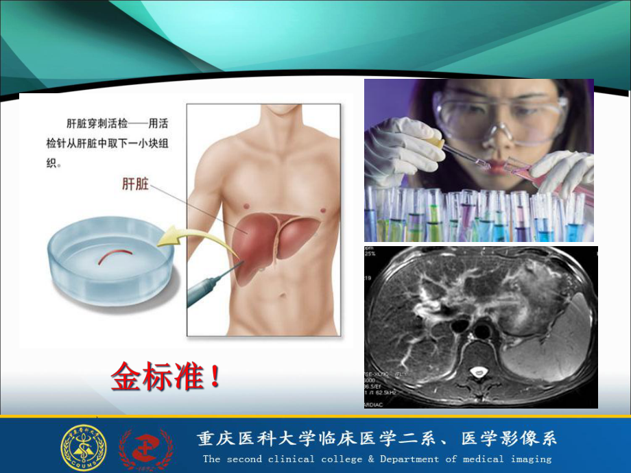 影像医学与核医学论文答辩课件.ppt_第3页