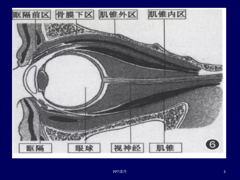 常见眼眶内肿瘤的影像诊断分析-课件.ppt_第3页