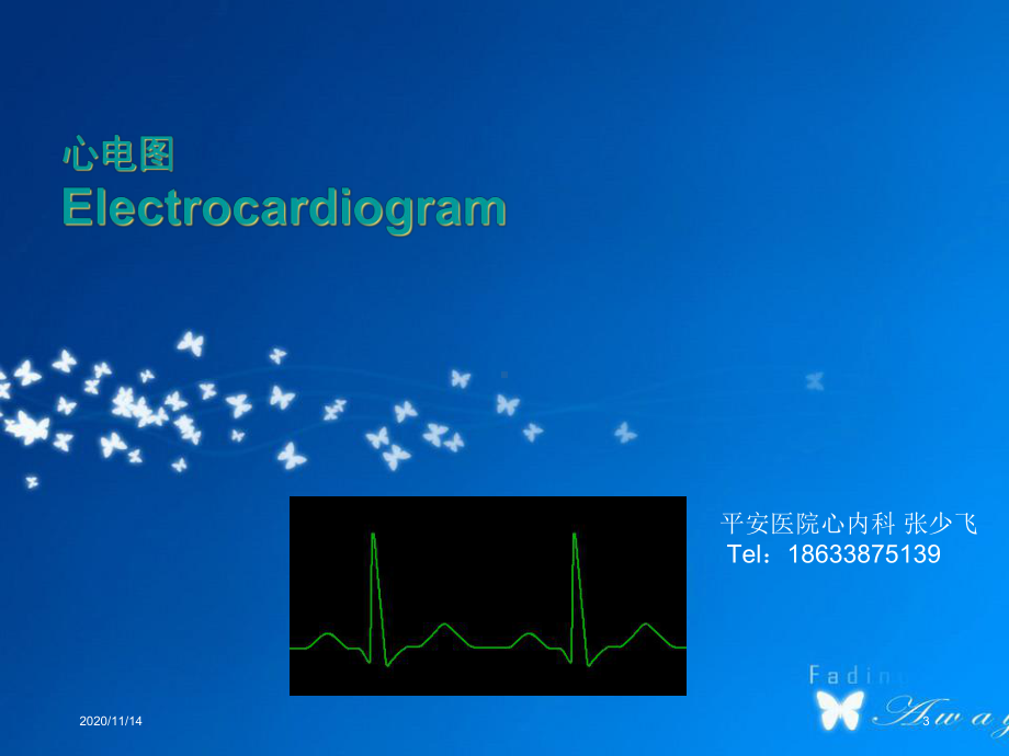 心电图诊断与鉴别诊断课件.ppt_第3页