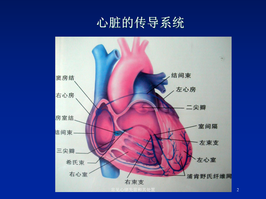 常见心律失常和其处置培训课件.ppt_第2页