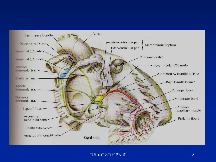 常见心律失常和其处置培训课件.ppt_第3页