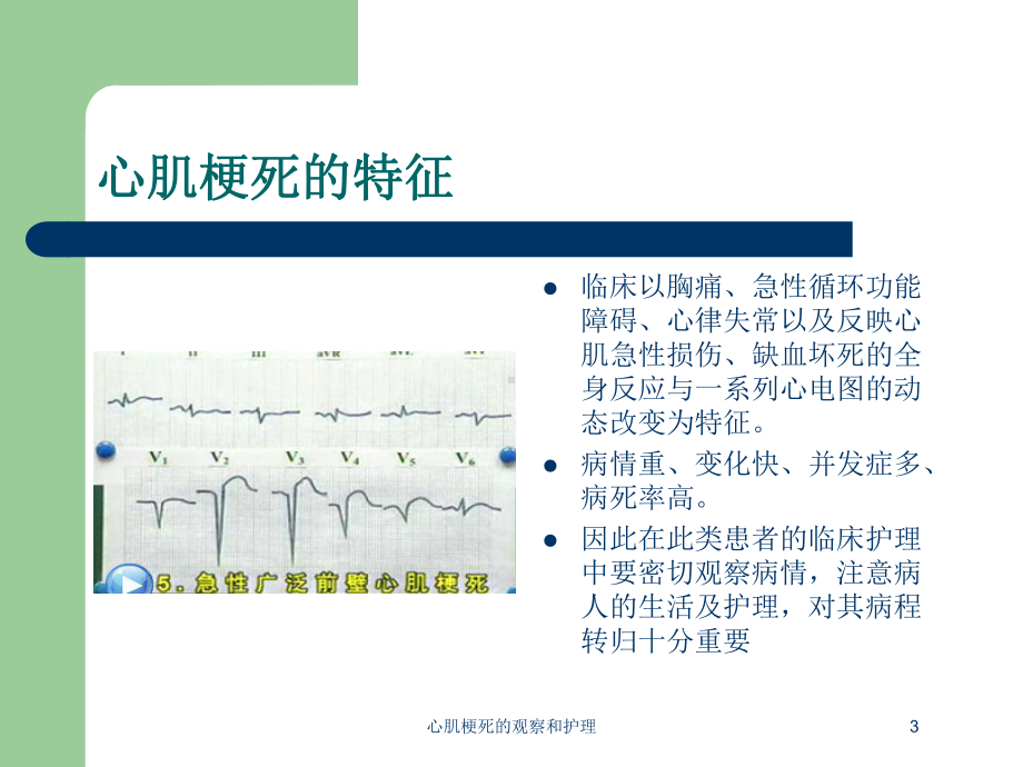 心肌梗死的观察和护理培训课件.ppt_第3页