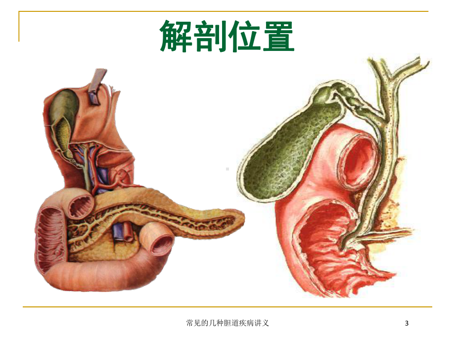 常见的几种胆道疾病讲义培训课件.ppt_第3页