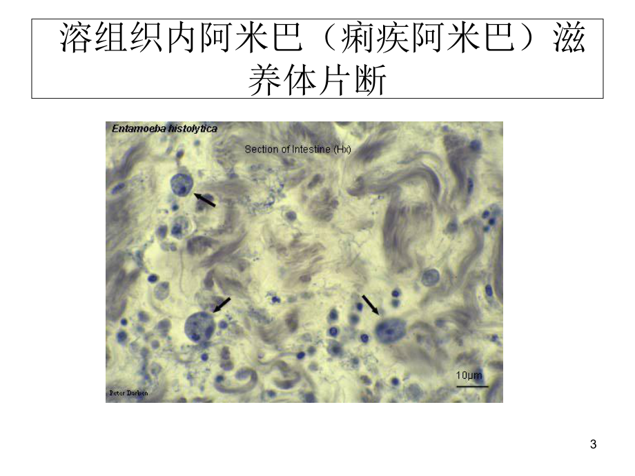 常见寄生虫图谱教学课件.ppt_第3页