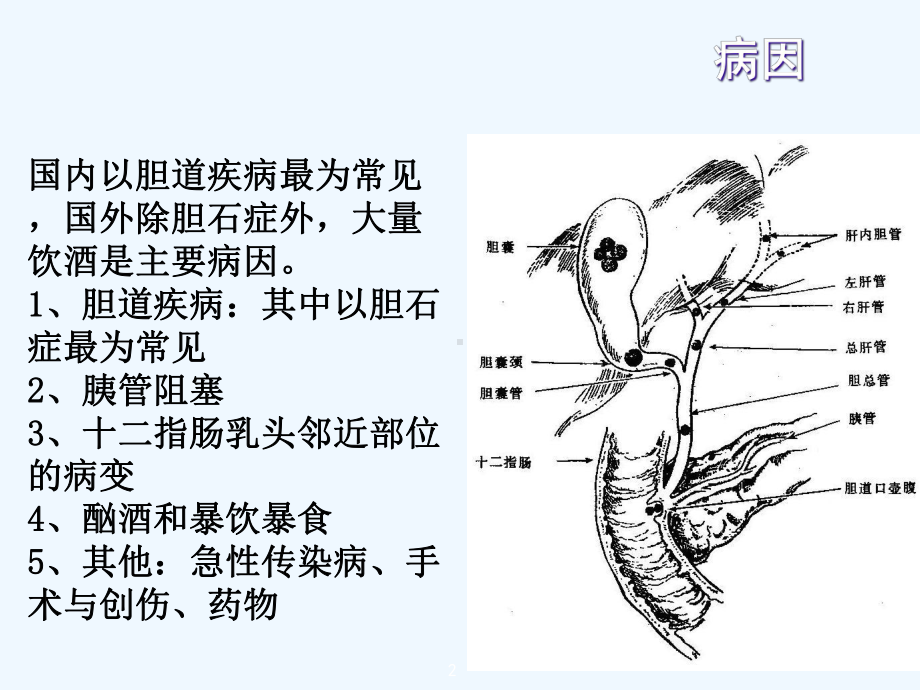 急性胰腺炎教学查房课件.ppt_第2页