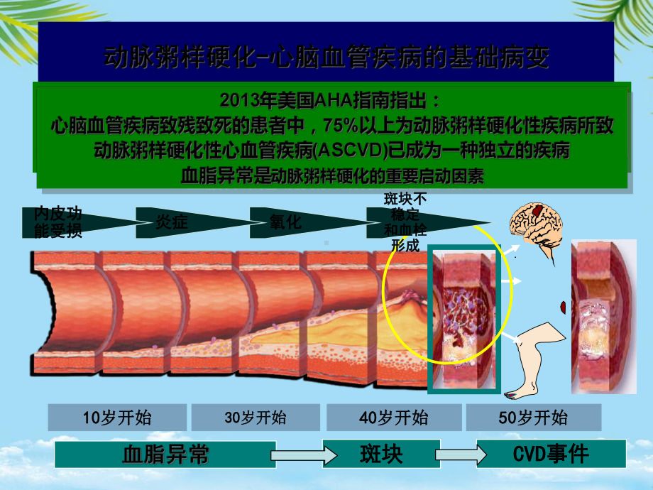 教培用血脂异常的危险分层与治疗课件-2.ppt_第3页