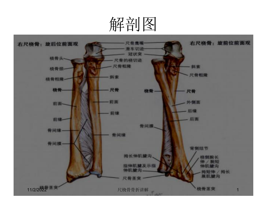 尺桡骨骨折讲解课件.ppt_第1页