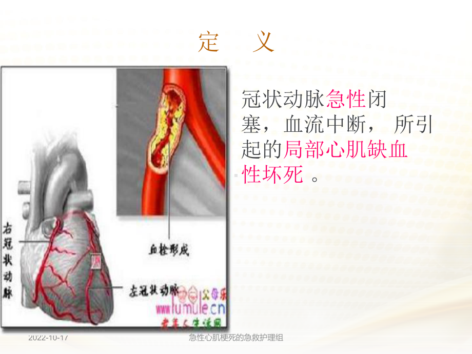 急性心肌梗死的急救护理组课件.ppt_第3页