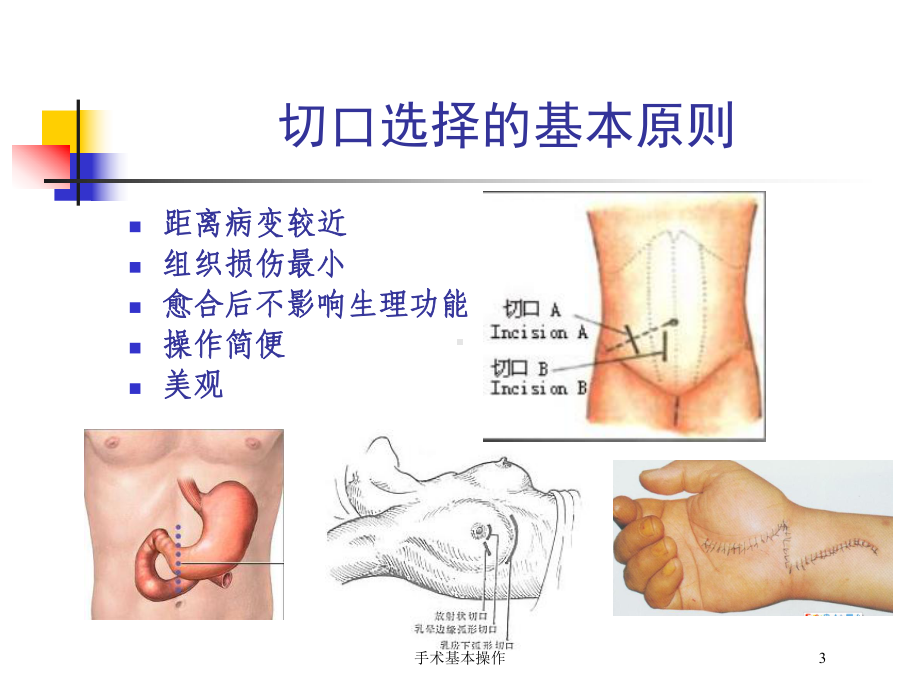 手术基本操作培训课件.ppt_第3页