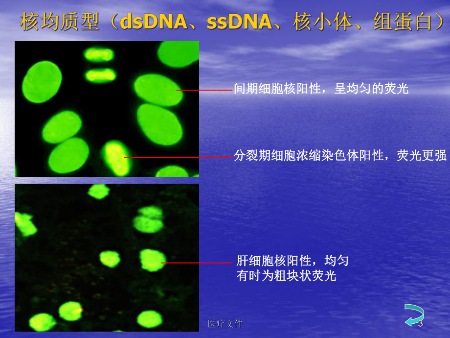 抗核抗体荧光片判读(医疗研究)课件.ppt_第3页