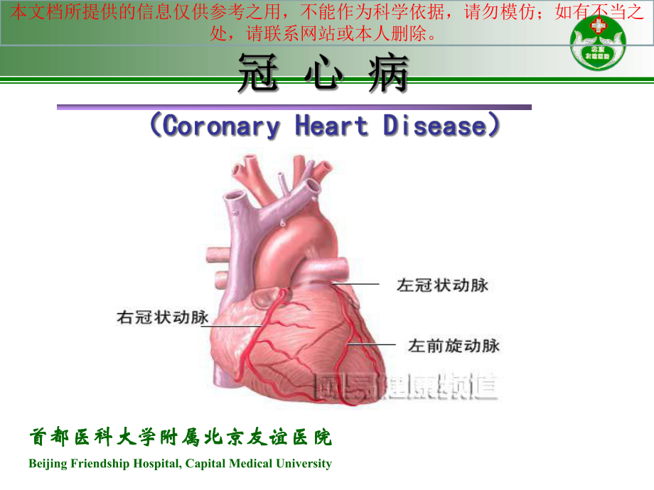 心绞痛和急性心肌梗死的识别培训课件.ppt_第2页