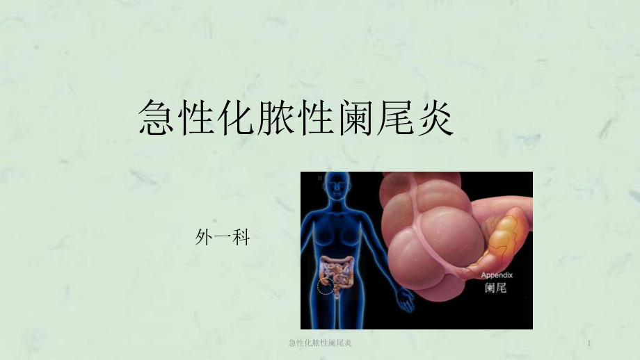 急性化脓性阑尾炎课件.ppt_第1页