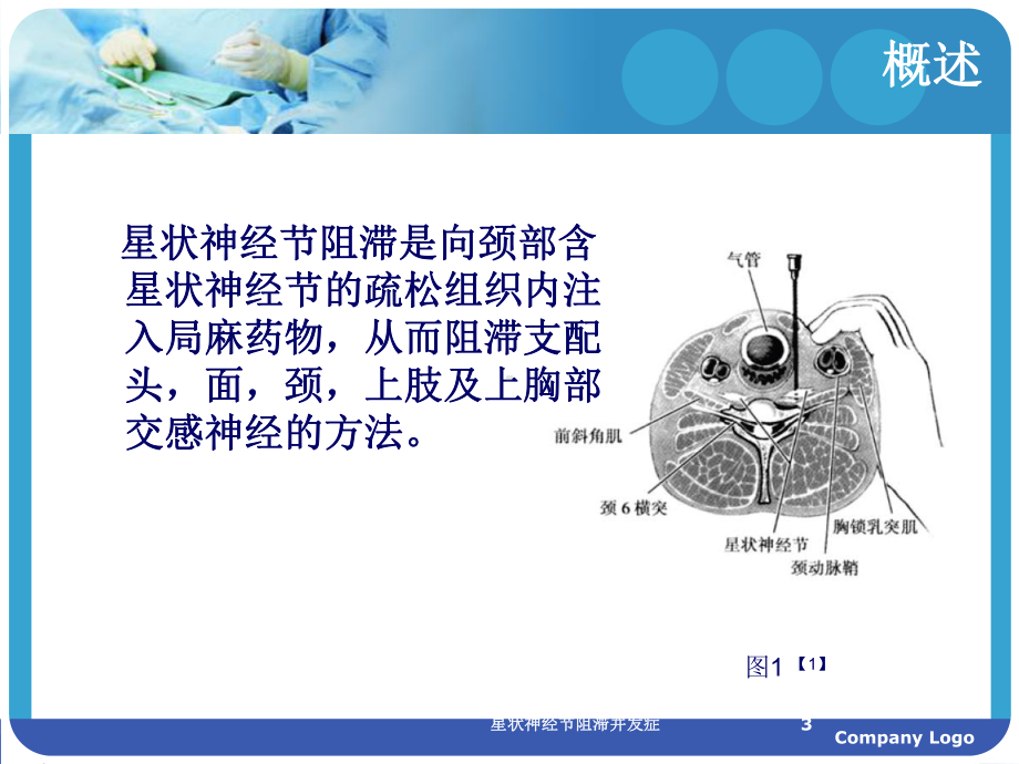 星状神经节阻滞并发症培训课件.ppt_第3页