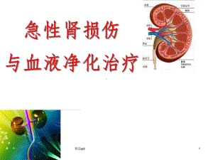 急性肾损伤与血液净化治疗课件-2.ppt