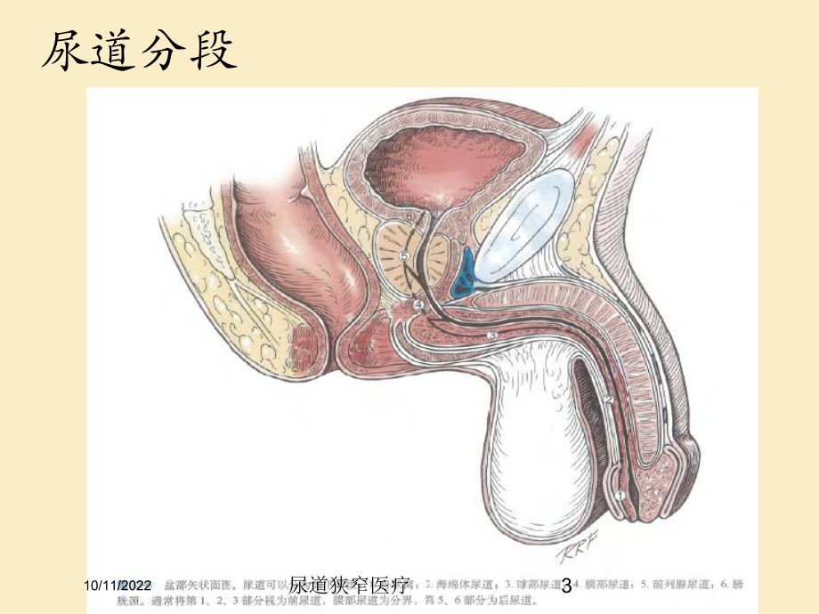 尿道狭窄医疗课件.ppt_第3页