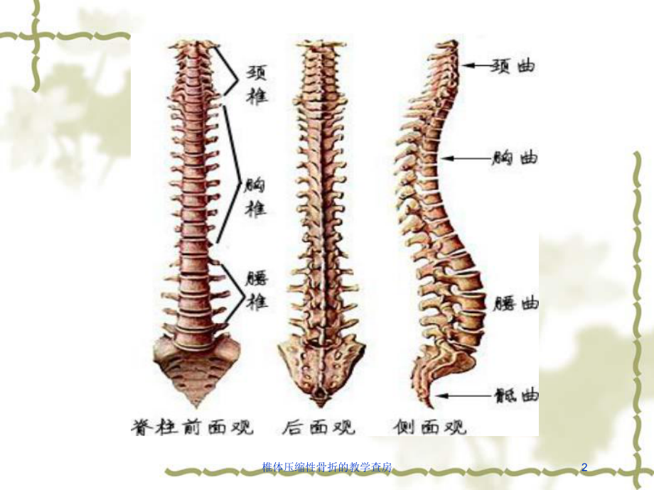 椎体压缩性骨折的教学查房培训课件.ppt_第2页