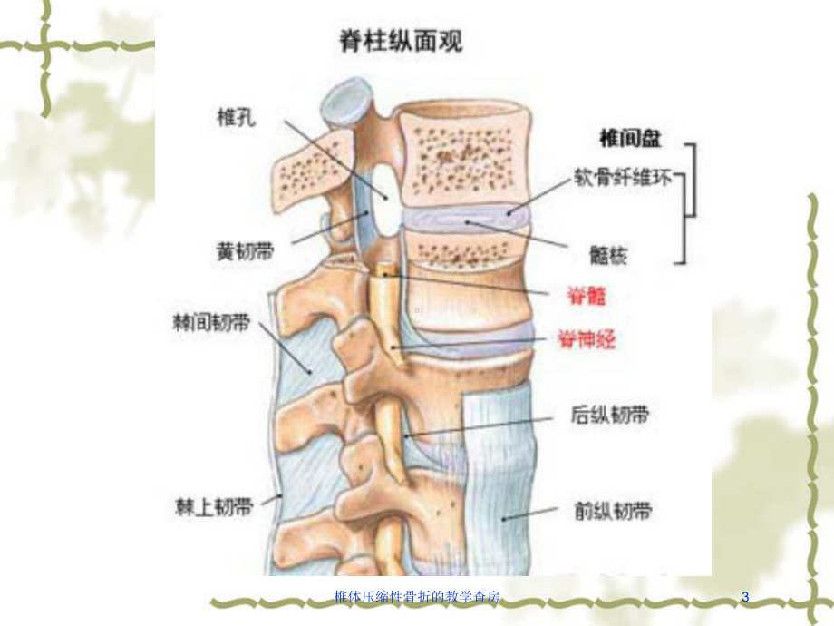 椎体压缩性骨折的教学查房培训课件.ppt_第3页