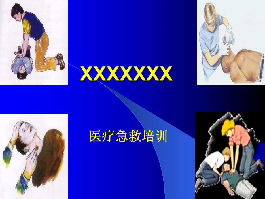 心肺复苏幻灯课件.ppt_第1页