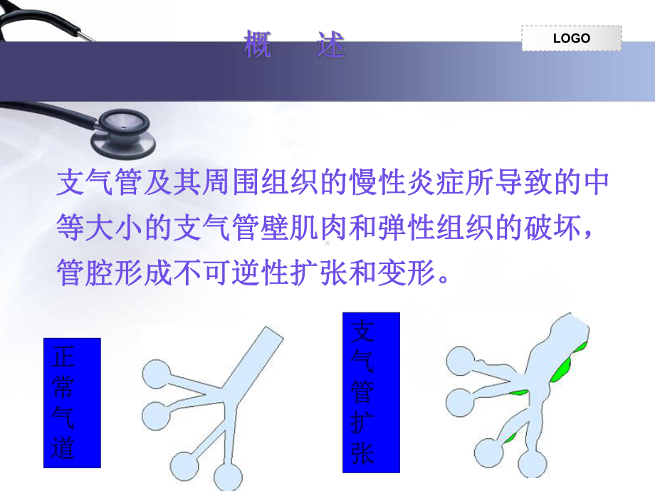 支气管扩张教材课件.ppt_第3页