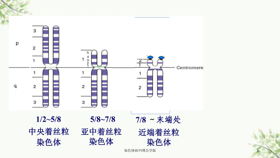 染色体病11傅自学版课件.ppt_第3页