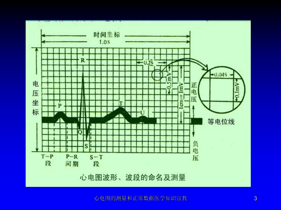 心电图的测量和正常数据医学知识宣教培训课件.ppt_第3页