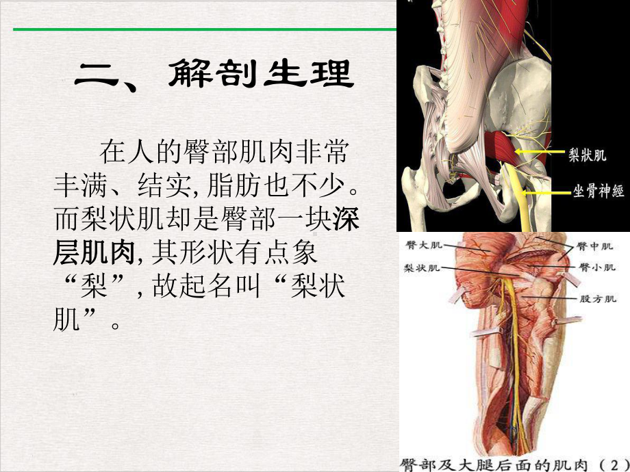 梨状肌综合征版课件.ppt_第3页