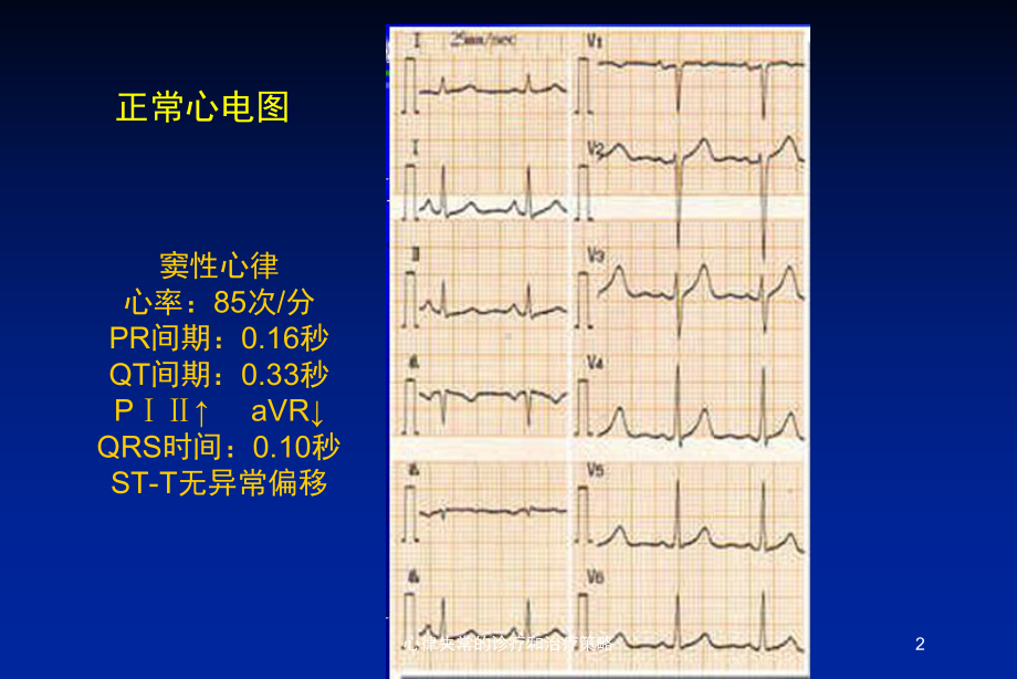 心律失常的诊疗和治疗策略培训课件.ppt_第2页