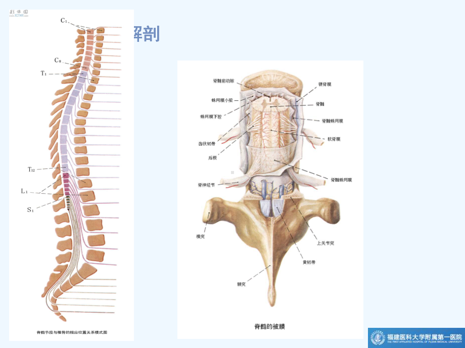 椎管肿瘤MR诊断课件.ppt_第2页