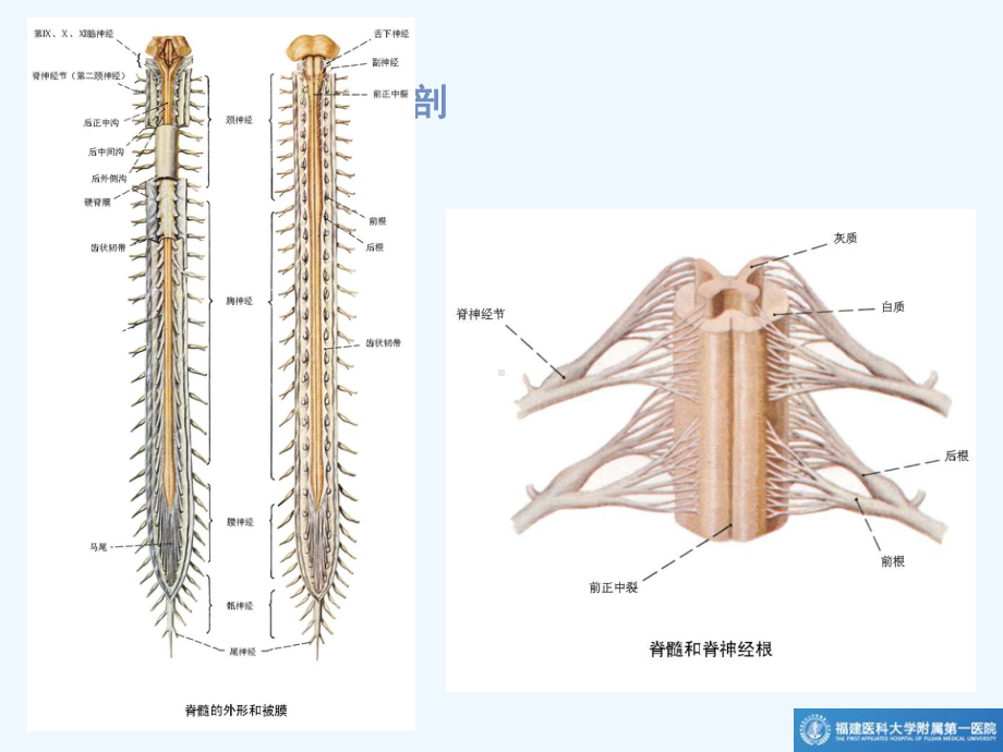 椎管肿瘤MR诊断课件.ppt_第3页