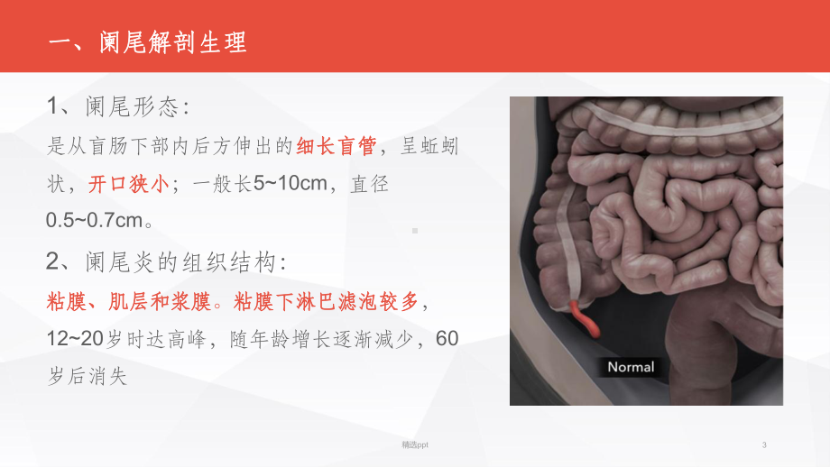 急性阑尾炎病人的护理40740课件.ppt_第3页