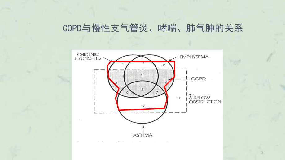 慢性阻塞性肺疾病内科课件.ppt_第3页