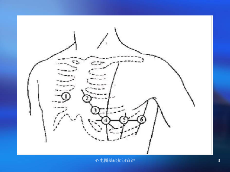 心电图基础知识宣讲培训课件.ppt_第3页