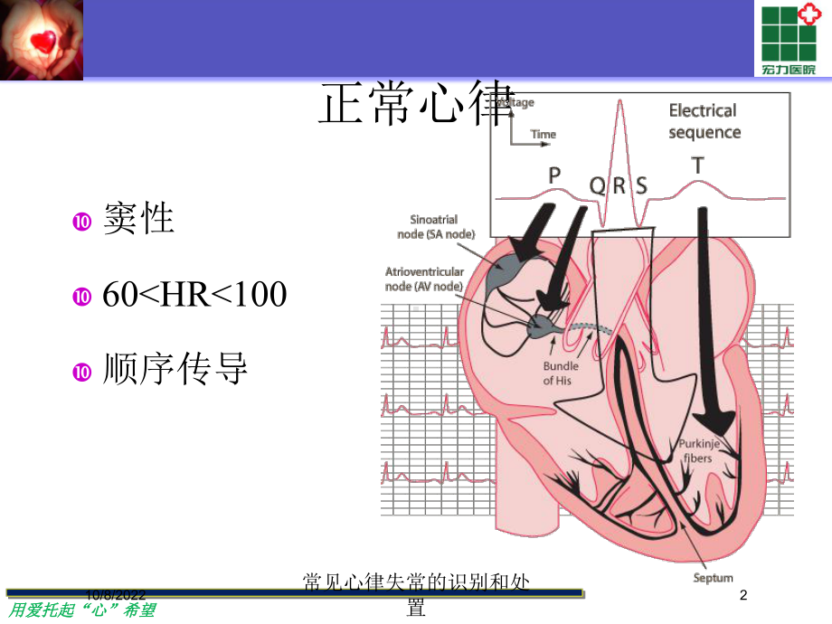 常见心律失常的识别和处置培训课件.ppt_第2页