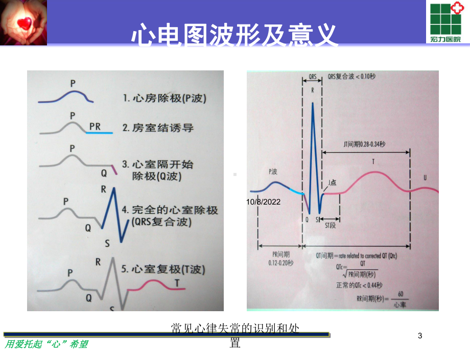 常见心律失常的识别和处置培训课件.ppt_第3页