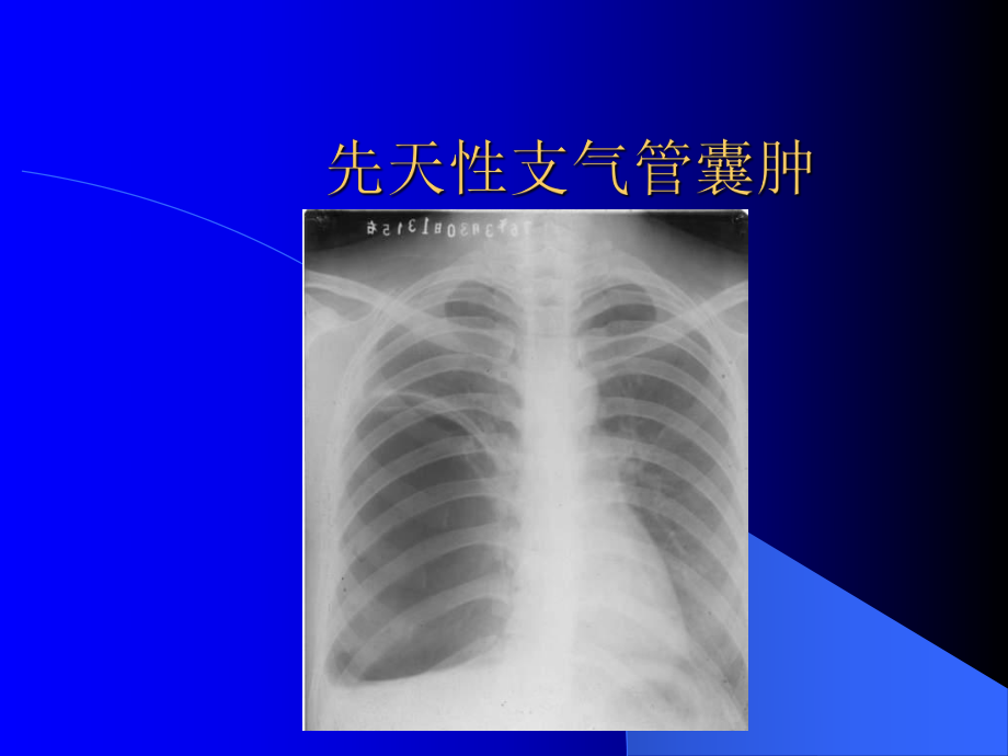 支气管疾病NXPowerLite课件.pptx_第3页