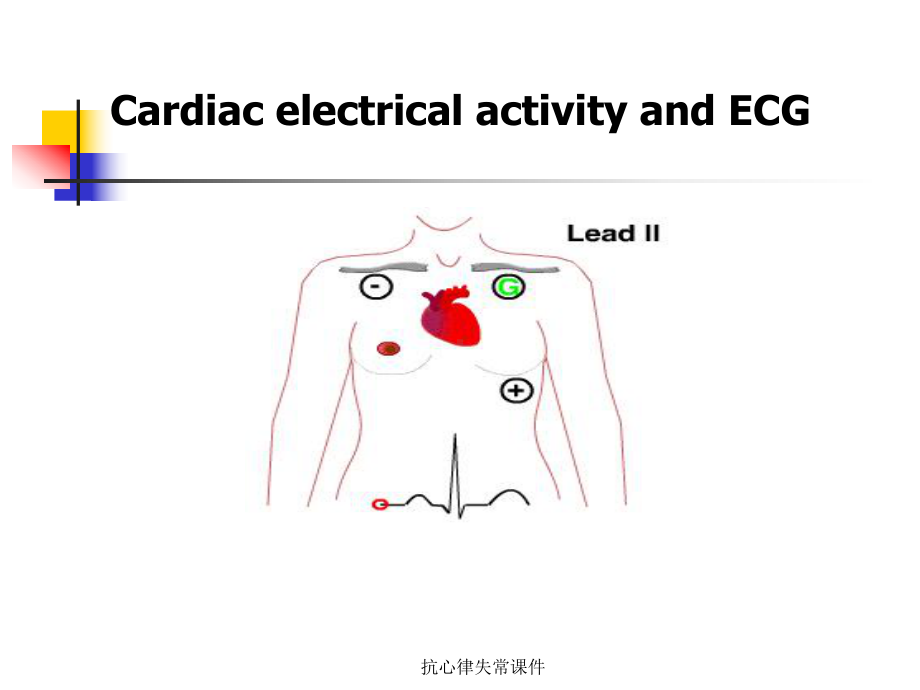 抗心律失常课件.ppt_第3页