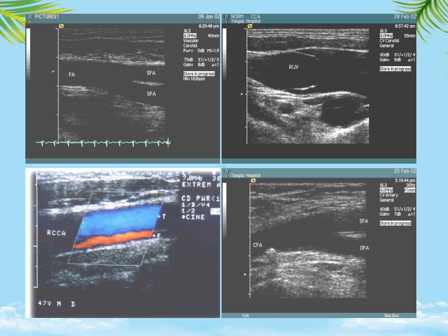 教培用血管超声检查技术课件.ppt_第3页