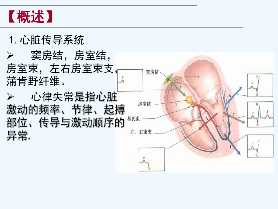 心电图与心律失常课件.ppt_第2页