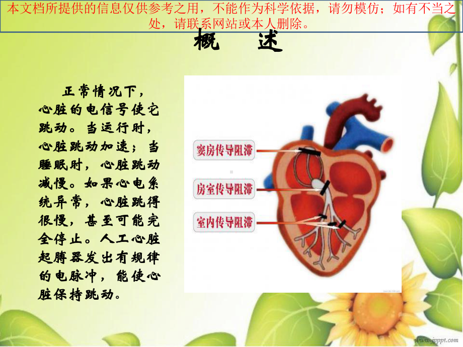 心脏永久起搏器植入术的医疗护理培训课件.ppt_第1页