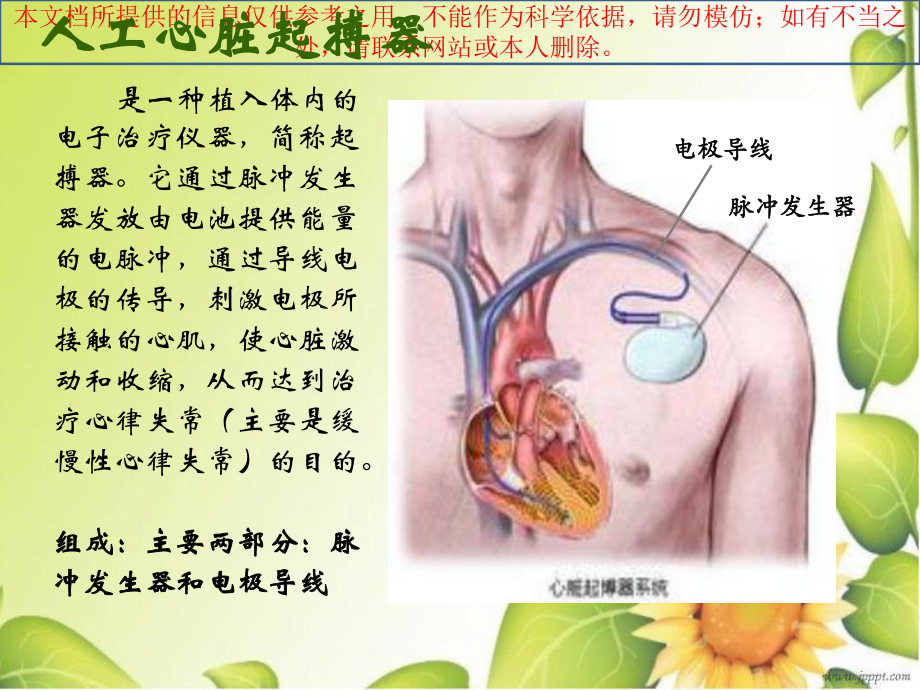 心脏永久起搏器植入术的医疗护理培训课件.ppt_第2页