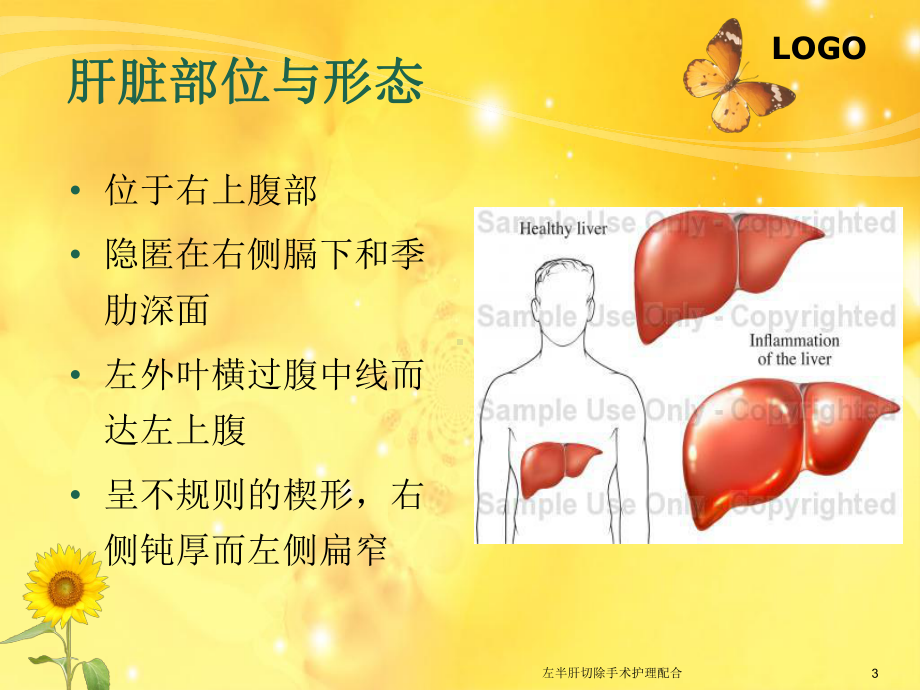 左半肝切除手术护理配合培训课件.ppt_第3页