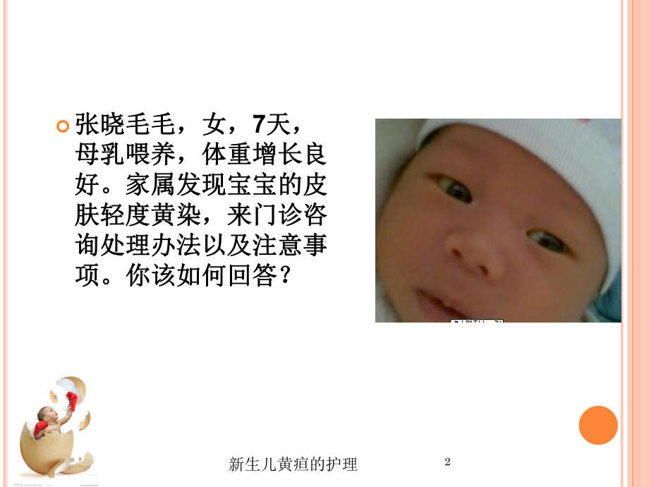 新生儿黄疸的护理培训课件.ppt_第2页